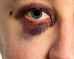 black eye colors and dark brown colored eyes