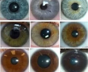 laser eye color change surgery prices before after
