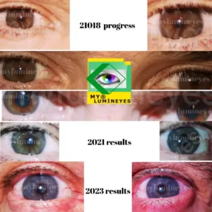 change your eye color 2023 before and after photos