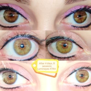 can i change my eye color naturally