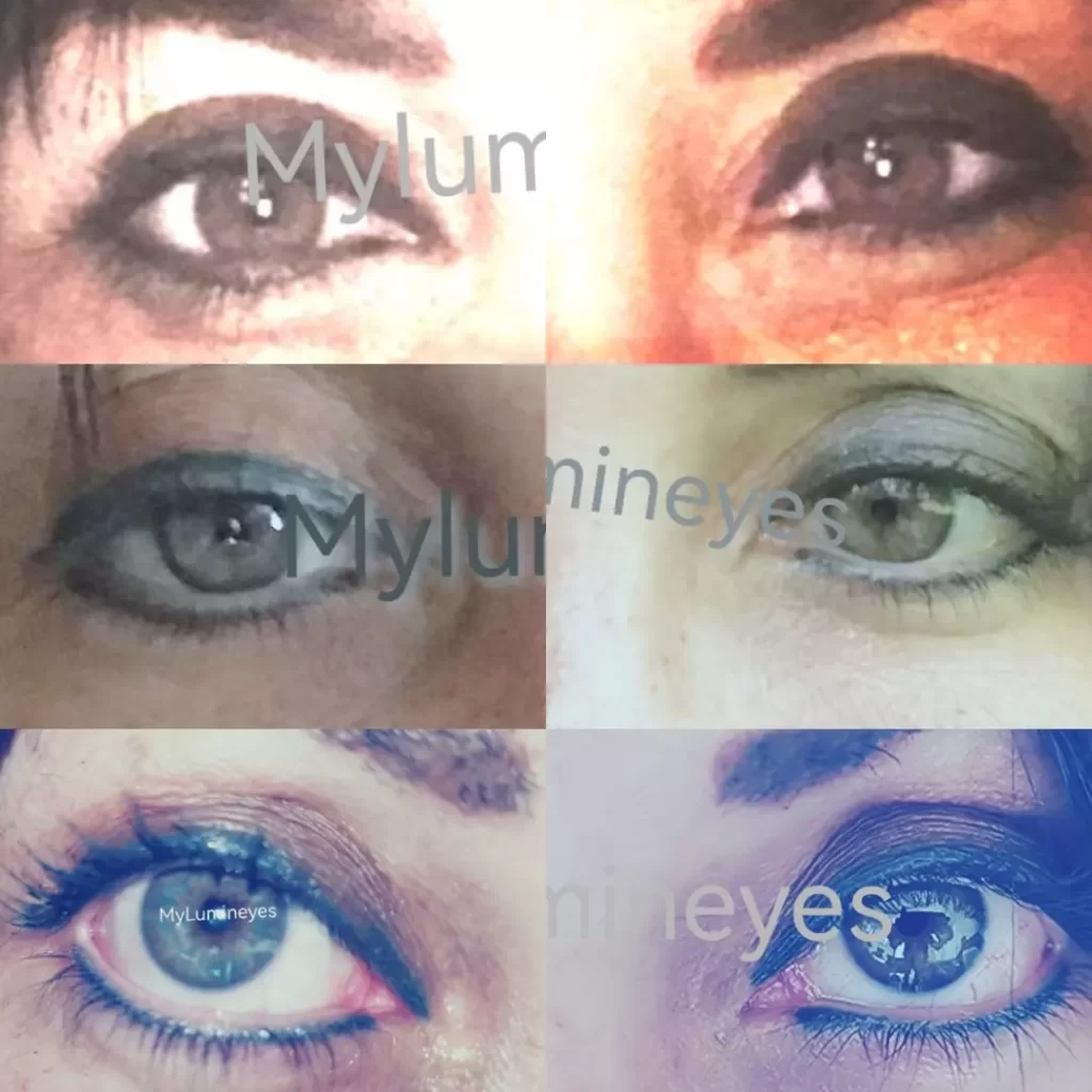 chirurgies de changement de couleur des yeux et traitement de changement de couleur des yeux