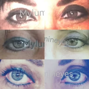 eye color change surgeries and changing eye color procedures