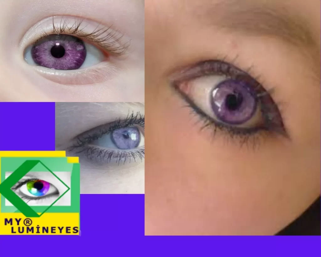 les personnes avec une mutation aux yeux violets