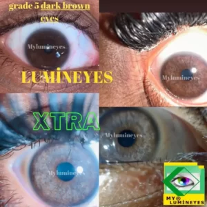 black eyes grey eye change