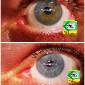 best changing eye color