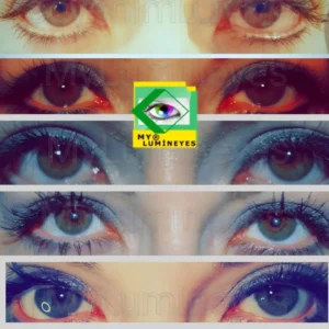 change eye color with laser