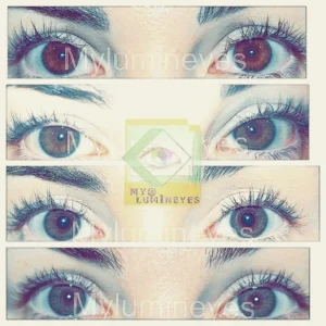 changing-eye-color-laser