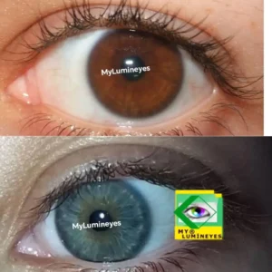 clinic-changing-eye-color