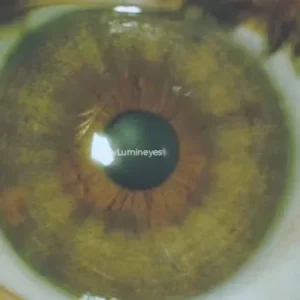 drops-changing-eye-color