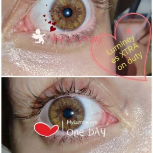 laser-changing-eye-color