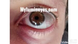 lumineyes eye color change laser