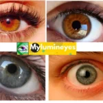 changing your eye color