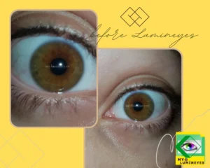 lumineyes laser eye color change