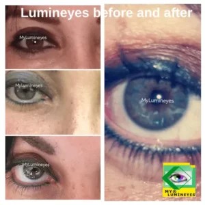 brown to blue green eye color