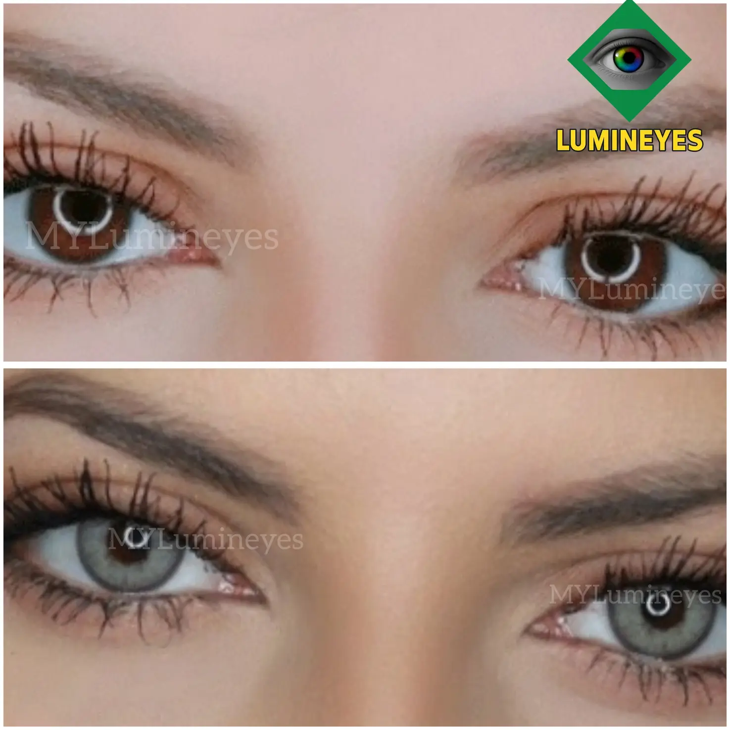 Eye color laser surgery Cost and Guide 9 laser eye color change