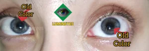 eye color change by lmylumineyes clinic