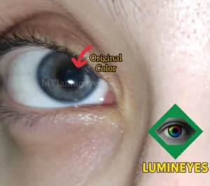 laser eye color surgery by mylumineyes