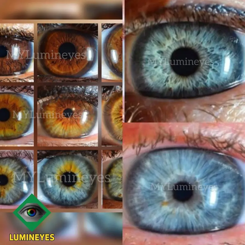 natural iris color variation and melanin distribution