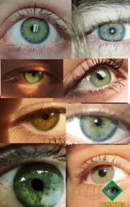 brown to green laser eye color change