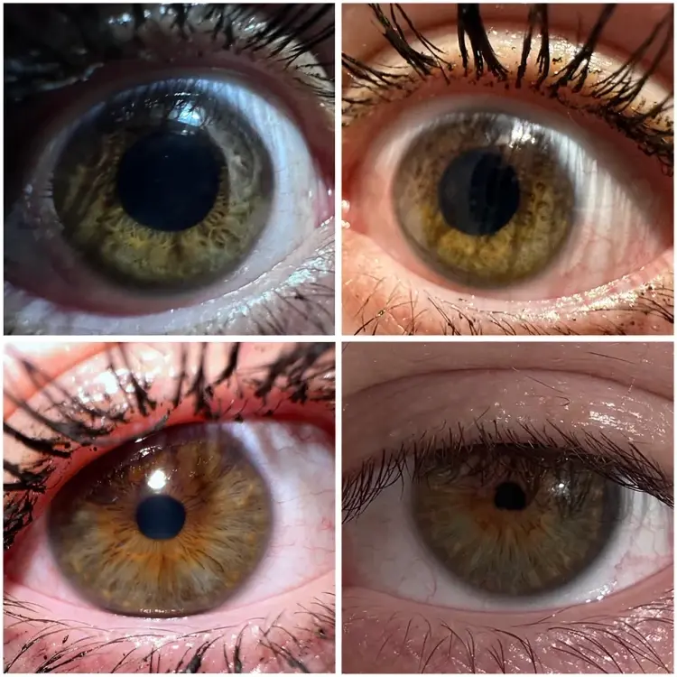 hazel eyes and hazel eye color