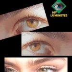 Laser eye color change recovery timeline showing post-procedure healing phases