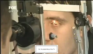 Follow-up eye examination and intraocular pressure monitoring after laser eye color change to confirm long-term stability