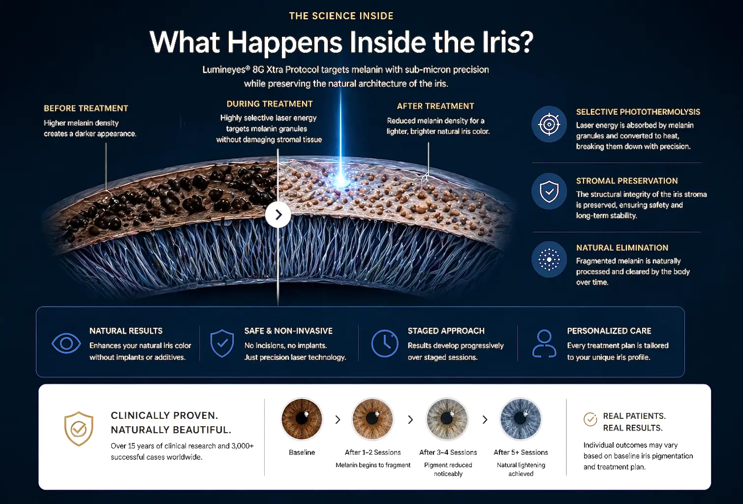 Step-by-step guide on how to change eye color with laser using Mylumineyes 8G Xtra protocol.
