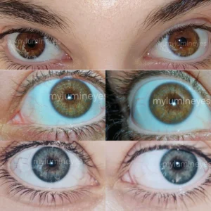 Before and after laser eye color change using the MyLumineyes® laser method showing iris color transformation.