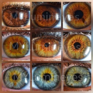 Can you change eye color with laser? Examples of natural eye colors