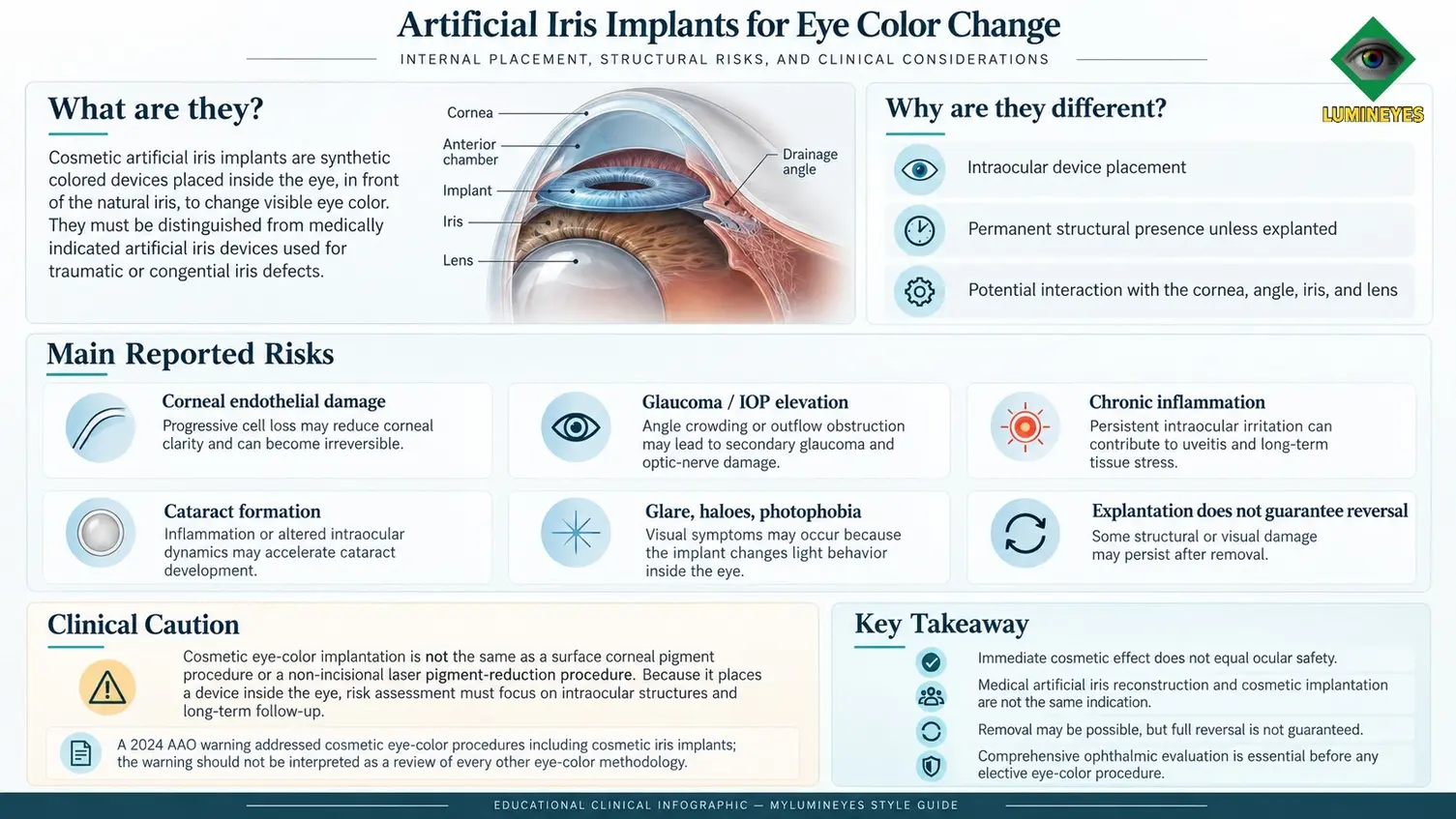 Medical infographic showing a cosmetic artificial iris implant in the anterior chamber, with the cornea, iris, lens and drainage angle labeled, and reported complications including glaucoma, endothelial damage, uveitis and cataract.