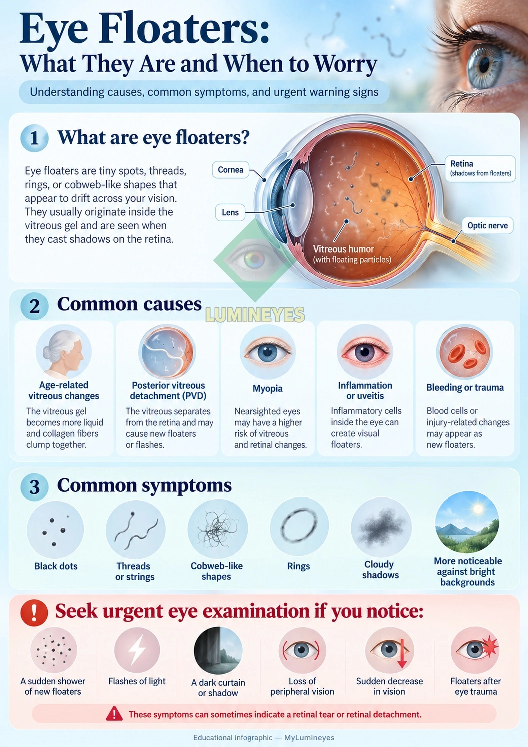 Eye Floaters: Causes, Symptoms and Warning Signs Eye floaters infographic showing common causes symptoms and retinal detachment warning signs