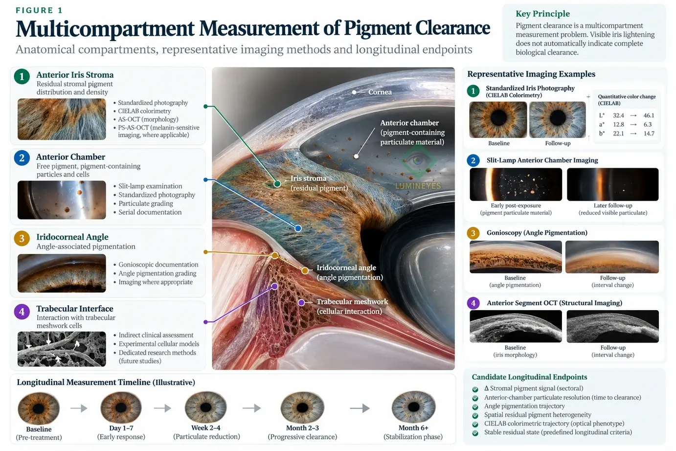 Scientific diagram showing multicompartment measurement of pigment clearance after iris-directed laser exposure, including residual stromal pigment, anterior-chamber particulate material, angle pigmentation, trabecular interaction, imaging methods, and longitudinal endpoints.