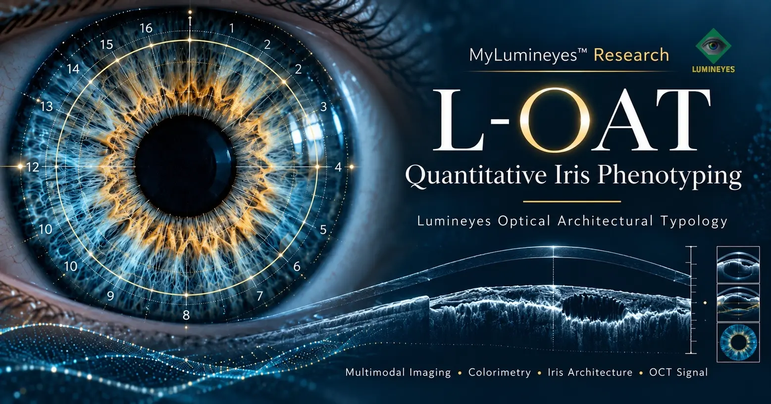 L-OAT quantitative iris phenotyping framework by MyLumineyes with iris mapping and OCT imaging